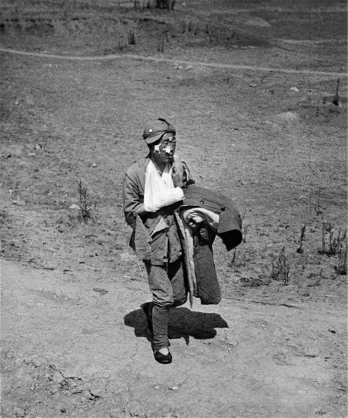 图片[4]-Old photo: The wounded soldiers in the bloody battle Taierzhuang walked to the hospital for a live shot-China Archive